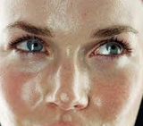 Kulit Berminyak Gelap Kusam