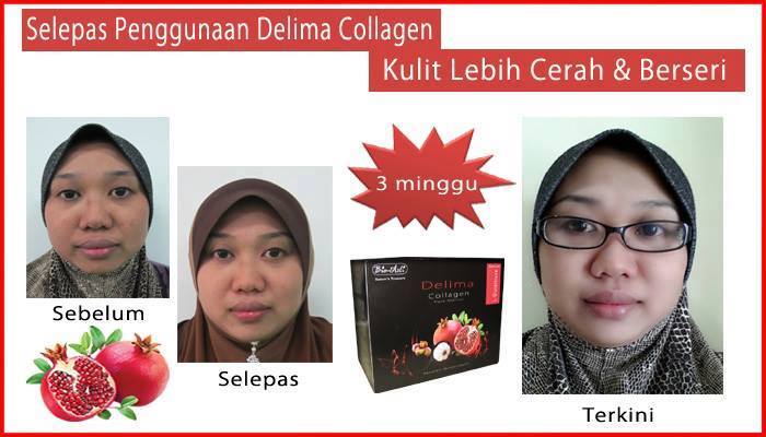 Delima Collagen - Pomegranate Collagen