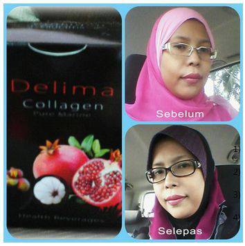 Delima Collagen - Pomegranate Collagen