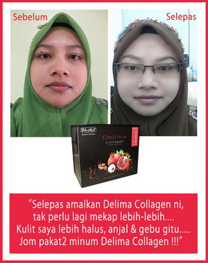 Delima Collagen - Pomegranate Collagen